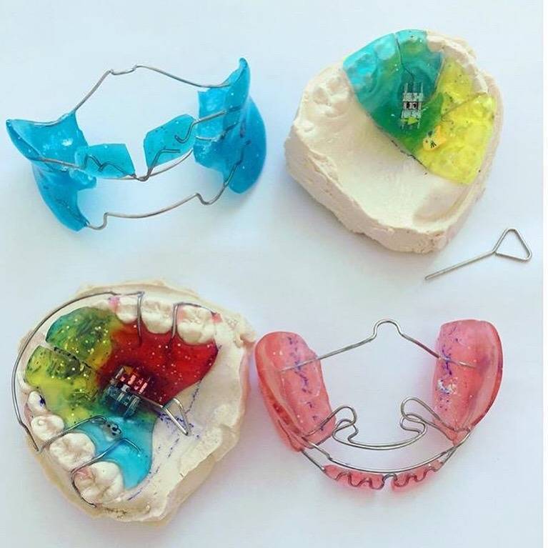Пластинки для исправления прикуса и выравнивания зубов, исправление зубов пластинками в клинике цэлт.